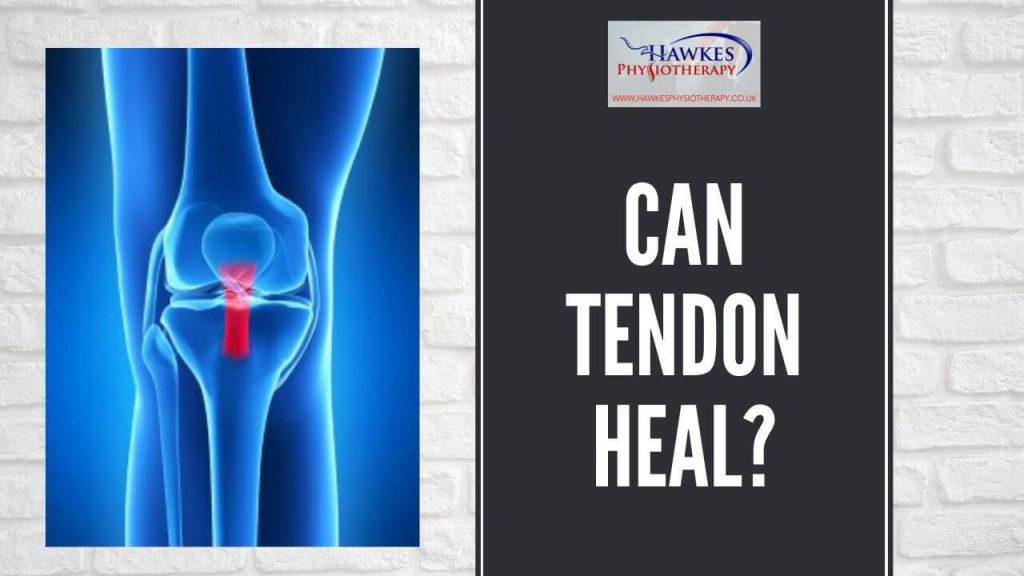 can-tendon-heal