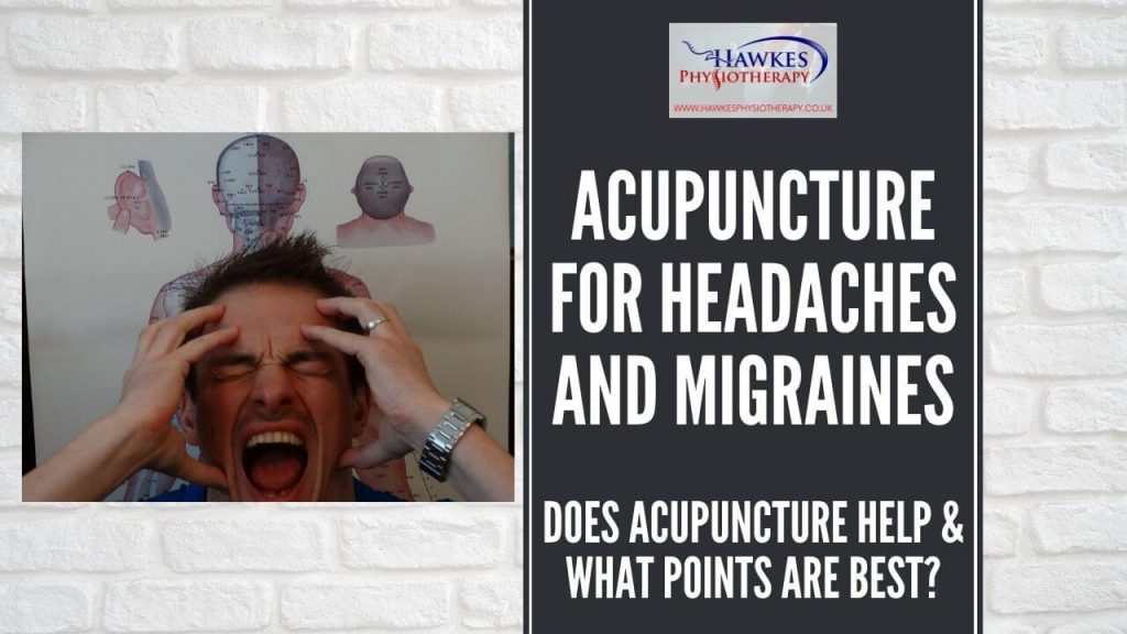 Does acupuncture help headaches and migraines?