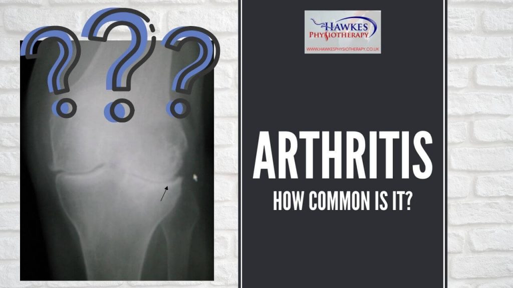 arthritis-how-common-is-it