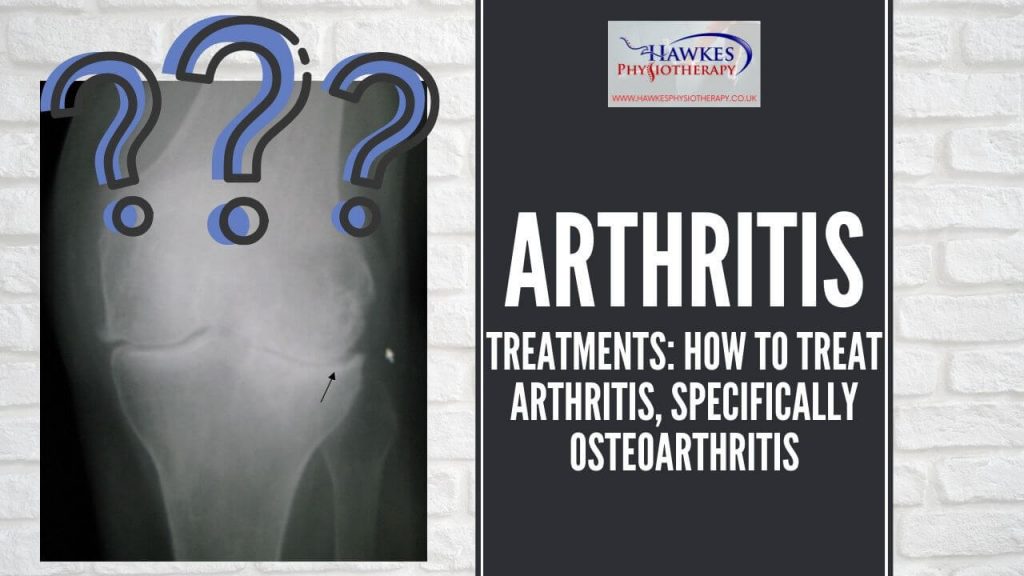 arthritis-treatments-how-to-treat-arthritis-specifically-osteoarthritis