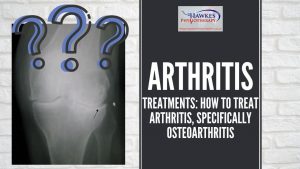 arthritis-treatments-how-to-treat-arthritis-specifically-osteoarthritis