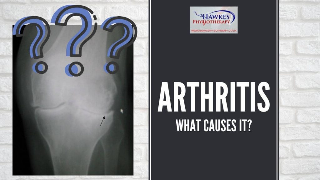 arthritis-what-causes-it