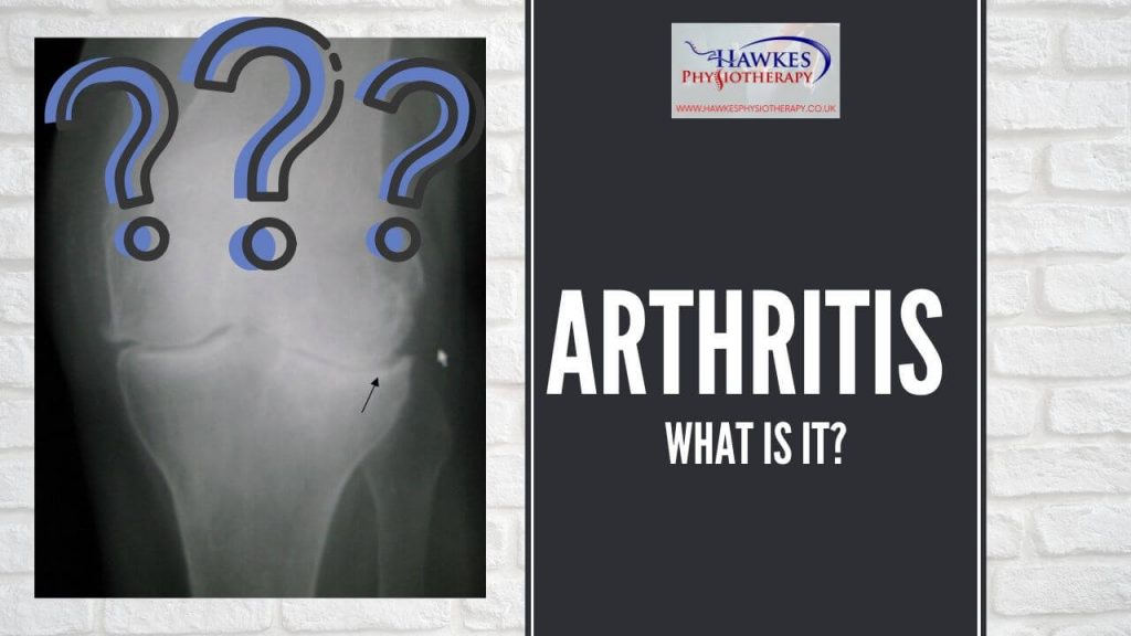 arthritis-what-is-it
