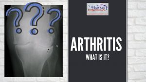 arthritis-what-is-it