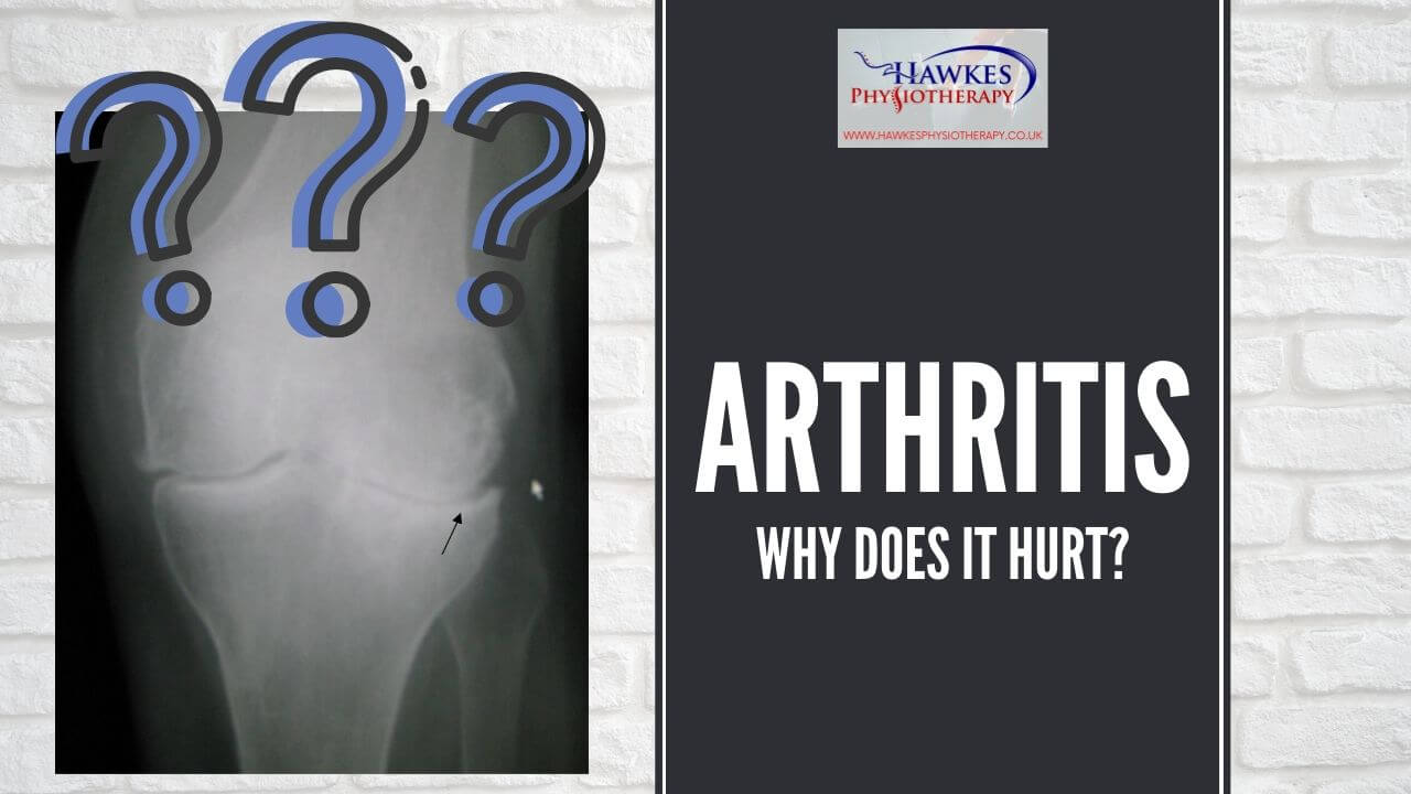 Arthritis Why does it hurt? Hawkes Physiotherapy