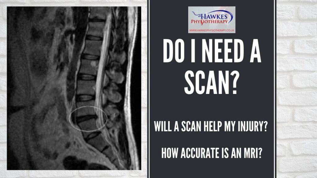 do-i-need-a-scan-will-a-scan-help-my-injury-how-accurate-is-an-mri