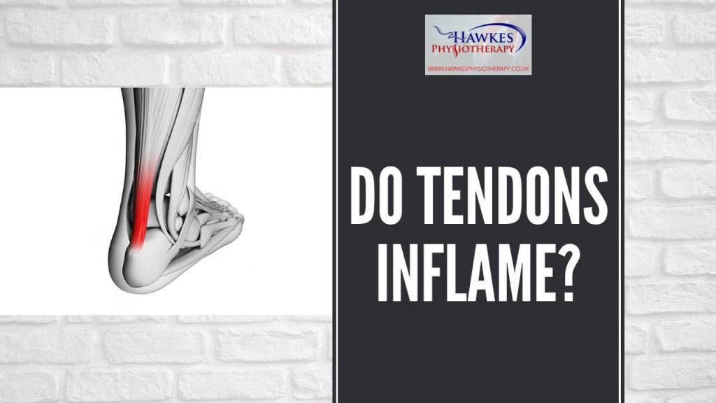 do-tendons-inflame