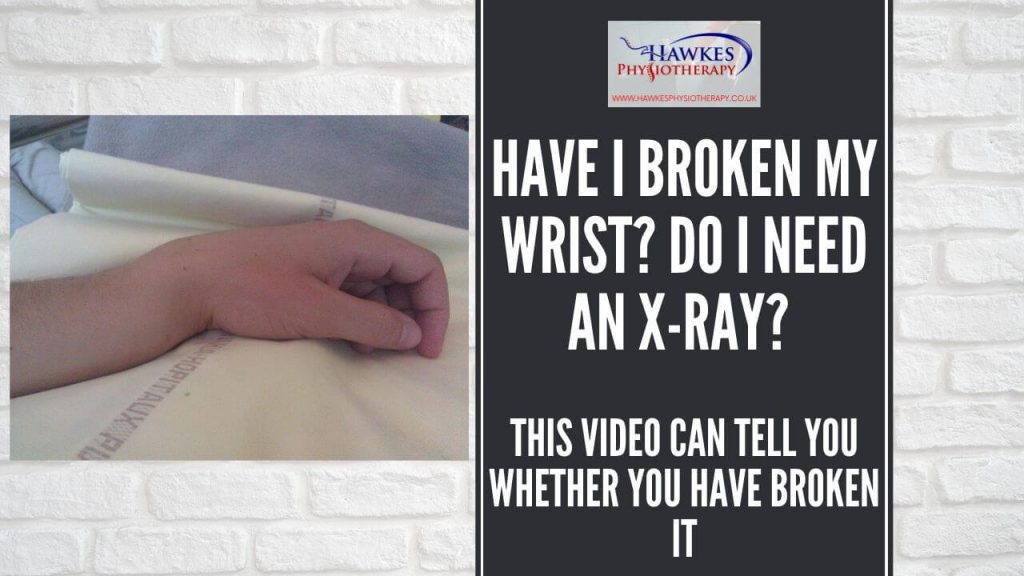 have-i-broken-my-wrist-do-i-need-an-x-ray-this-video-can-tell-you-whether-you-have-broken-it