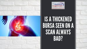 is-a-thickened-bursa-seen-on-a-scan-always-bad