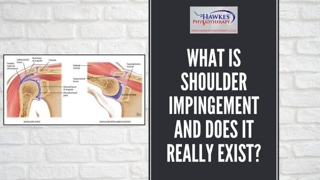what-is-shoulder-impingement-and-does-it-really-exist