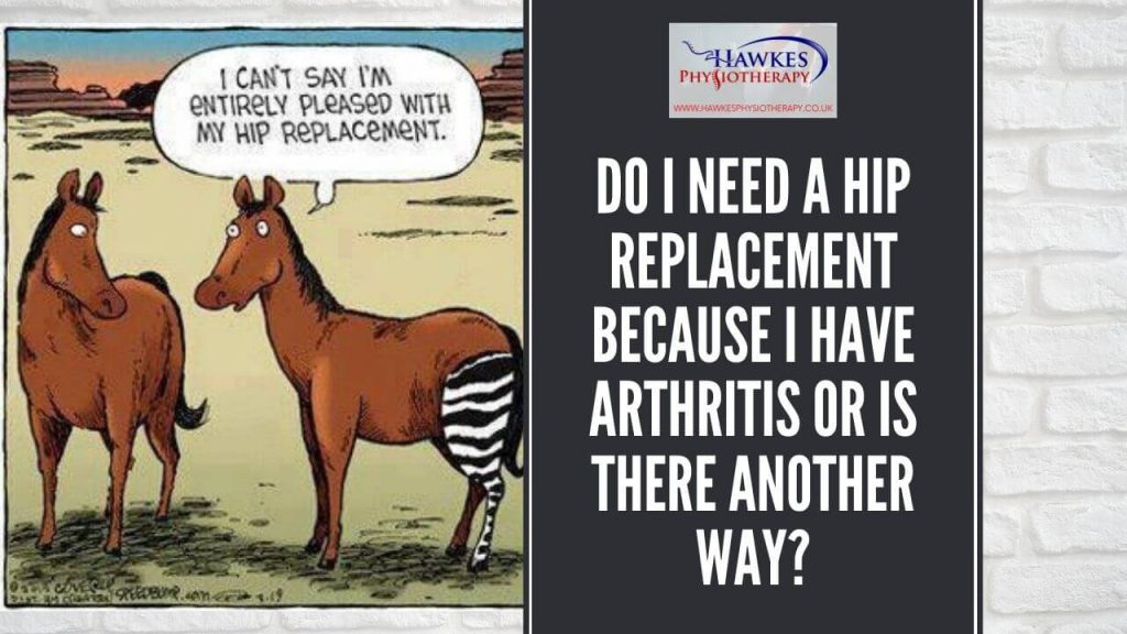 do-i-need-a-hip-replacement-because-i-have-arthritis-or-is-there-another-way