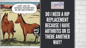 do-i-need-a-hip-replacement-because-i-have-arthritis-or-is-there-another-way