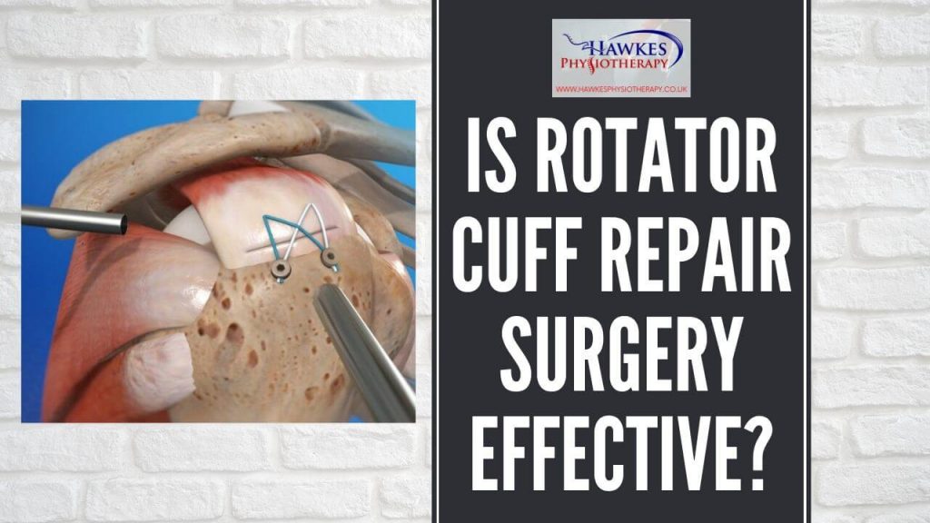 is-rotator-cuff-repair-surgery-effective