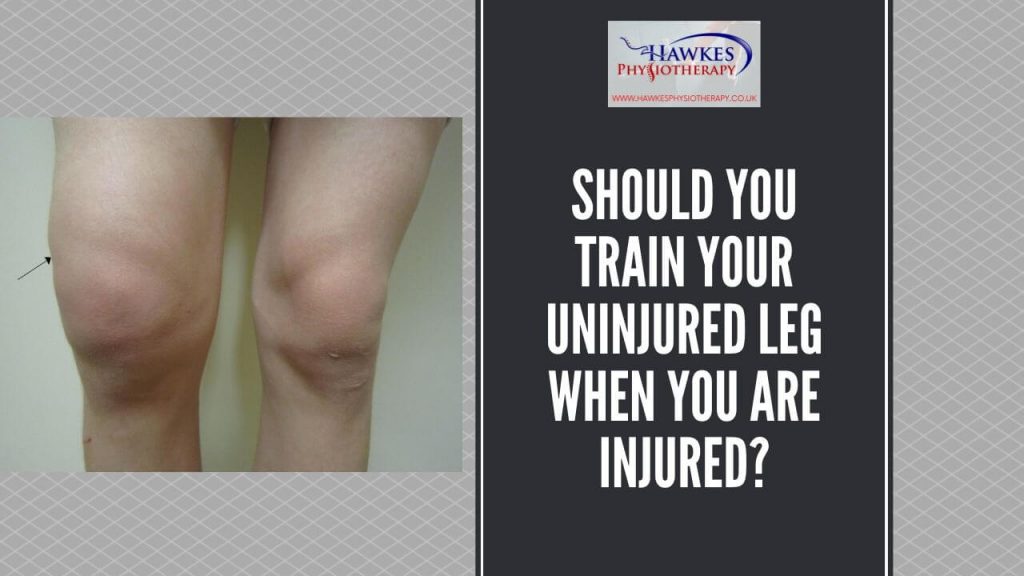 should-you-train-your-uninjured-leg-when-you-are-injured