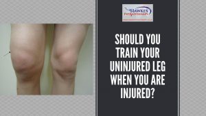 should-you-train-your-uninjured-leg-when-you-are-injured