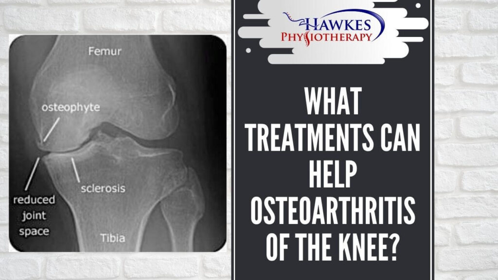 What treatments can help osteoarthritis of the knee?