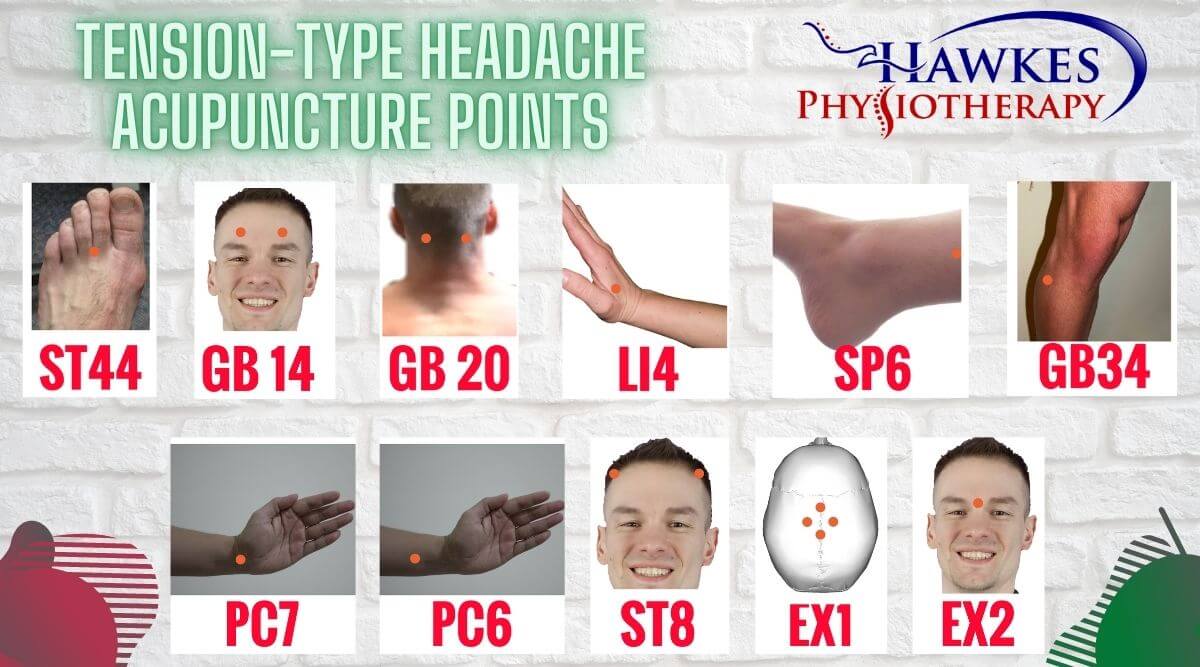 Does acupuncture help headaches and migraines?