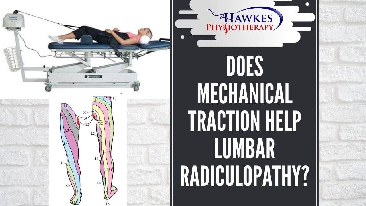 Does mechanical Traction help Lumbar Radiculopathy?